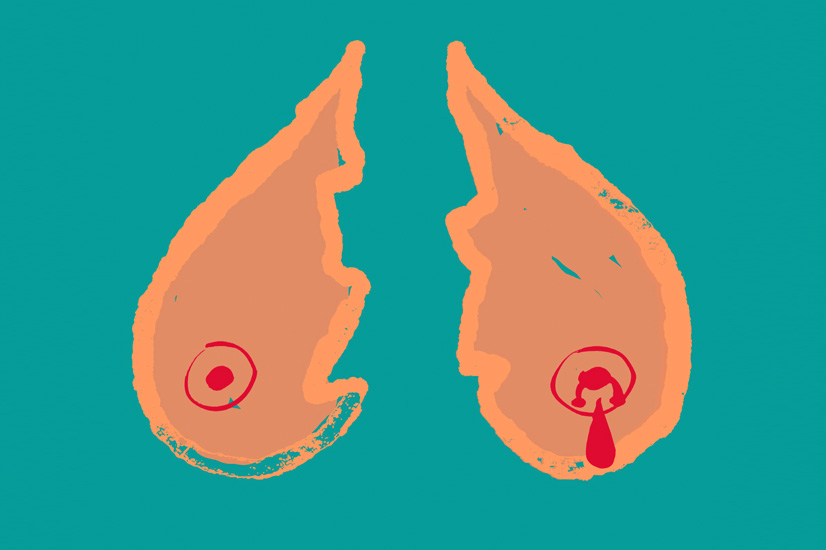 LIMERENSSI